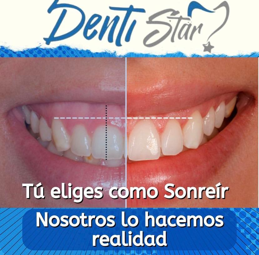 DENTISTAR3